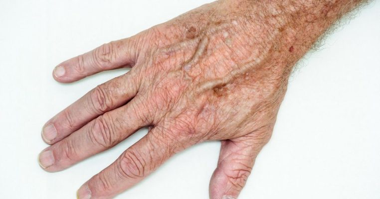 Da Đồi Mồi Sống Lâu: Bí Quyết Trường Thọ Khiến Nhiều Người Bất Ngờ
