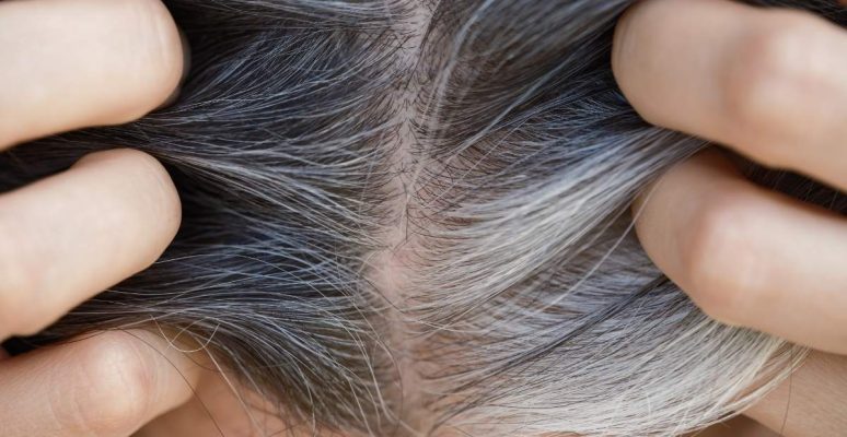 Máu xấu tóc bạc nên ăn gì? Thực phẩm bổ sung ngừa bạc sớm