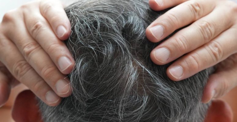 Tóc bạc nhanh: Giải pháp điều trị hiệu quả và an toàn tại nhà