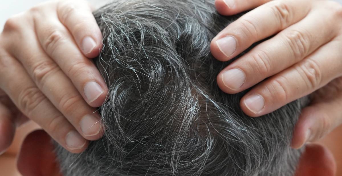 Tóc bạc nhanh: Giải pháp điều trị hiệu quả và an toàn tại nhà