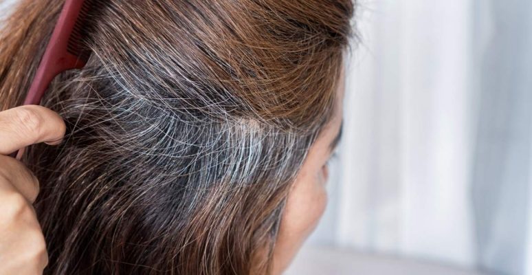 Tóc bạc nhiều do đâu? Cách khắc phục an toàn và hiệu quả nhất