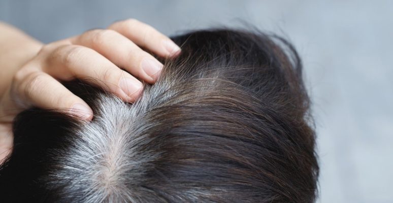 Tóc bạc từ gốc hay ngọn? Phân biệt nguyên nhân và cách xử lý